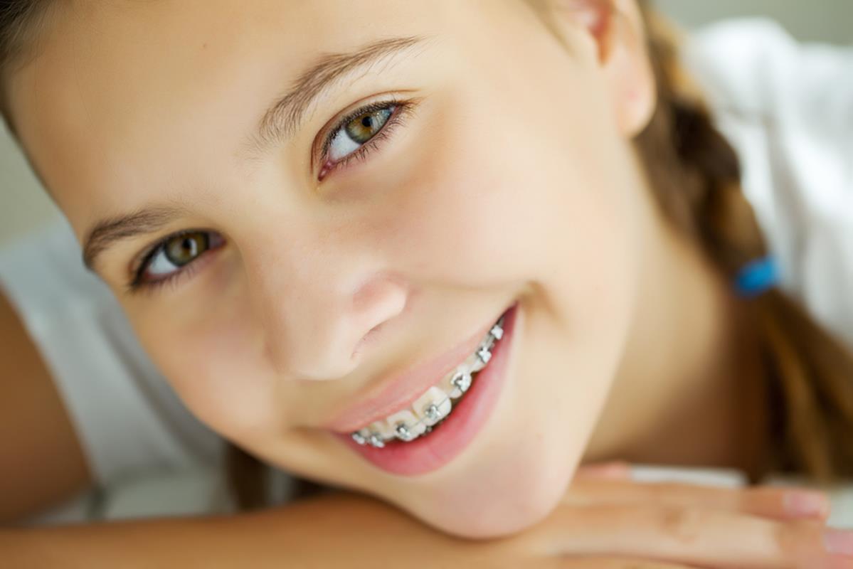 Traditional Braces 1475 Pine Grove Road Suite 107, Steamboat Springs, CO 80487